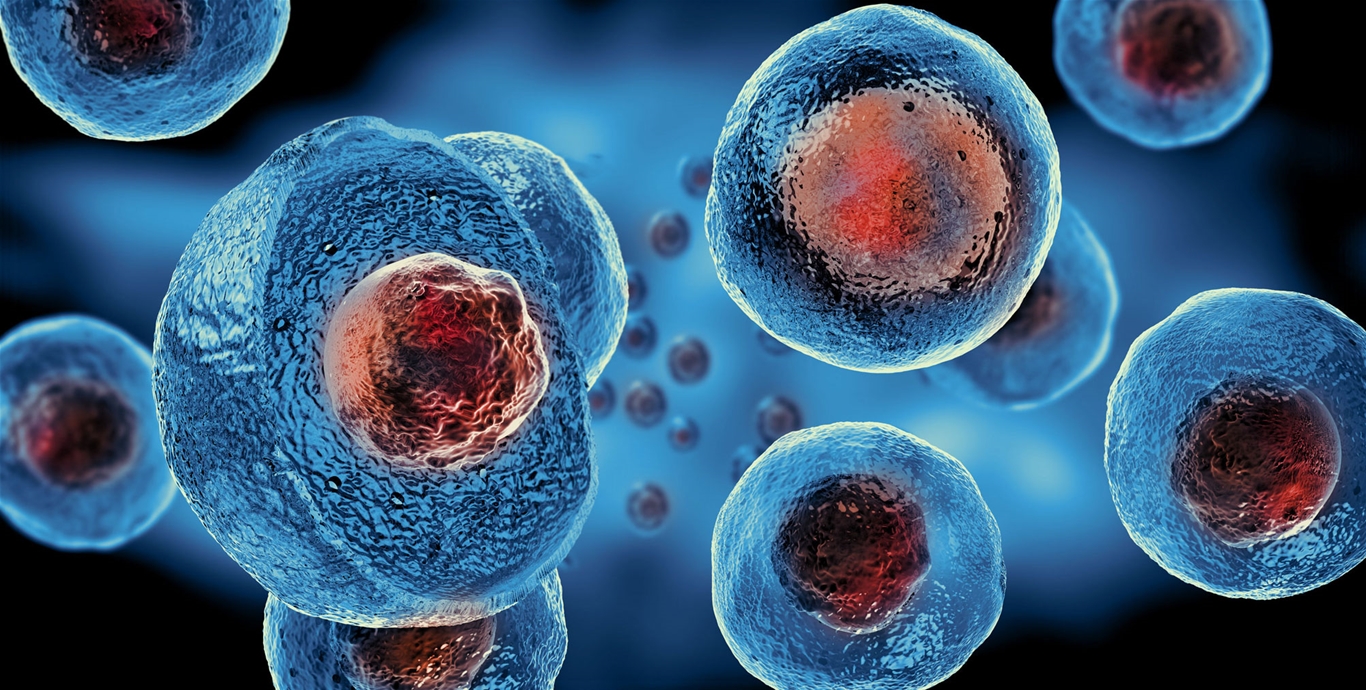 Tế bào gốc tự nhân có thể được sử dụng trong điều trị các cơn đau mãn tính
